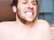 crioterapia para rejuvenecer bajar peso Estados Unidos