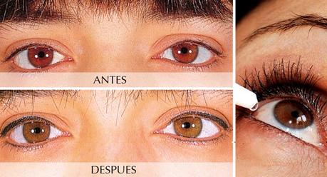 Aclarar los ojos con remedios naturales o con tratamientos médicos