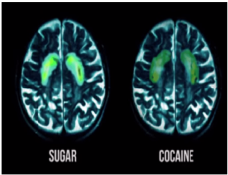 Azúcar y grasas: tan adictivas como la cocaína
