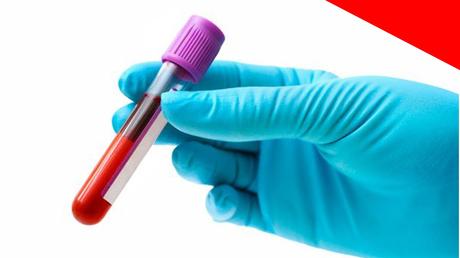 Cáncer: Un análisis de sangre puede servir para detectarlo Cáncer: Un análisis de sangre puede servir para detectarlo