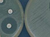 Antibióticos: funcionan laboratorio pero humano