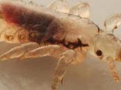 Piojos mutantes: inmumes tratamientos habituales