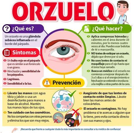 Orzuelo: ¿qué puedes hacer para eliminarlo? Orzuelo: ¿qué puedes hacer para eliminarlo?