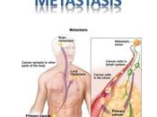 lucha molecular contra metástasis