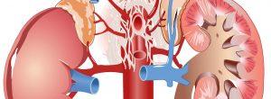La importancia del aumento de los niveles de creatinina