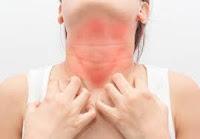 Las Alergias son el resultado de un desequilibrio entre las Citoquinas