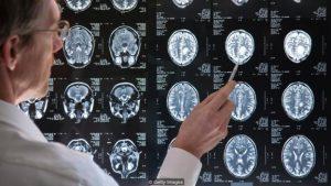 La mujer cuyo tumor hizo que su religión sea mortal p05zm8tv