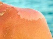 ¿Por bronceamos estando bajo sol?