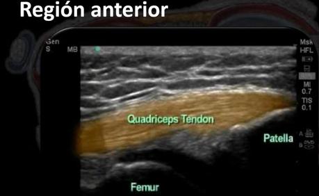 Ultrasonido de Rodilla Anatomía mas Patología