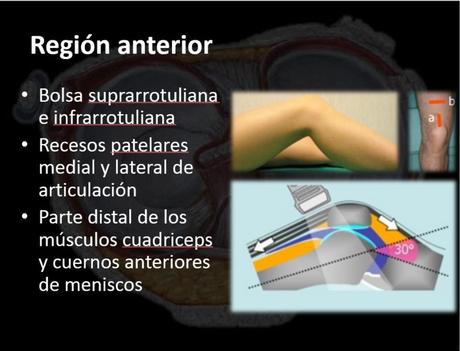 Ultrasonido de Rodilla Anatomía mas Patología