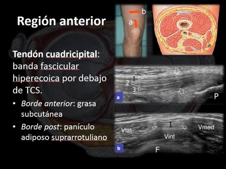 Ultrasonido de Rodilla Anatomía mas Patología