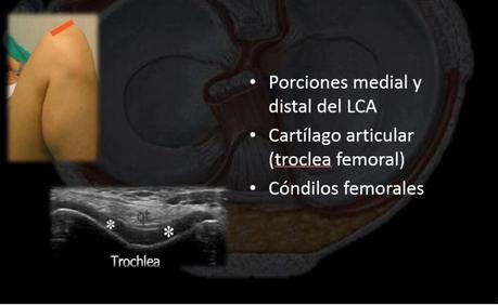 Ultrasonido de Rodilla Anatomía mas Patología