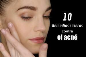 Remedios Caseros Para Eliminar El Acne y Recuperar La Confianza