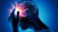 Identifican Nuevos Factores de Riesgo para el Accidente Cerebrovascular