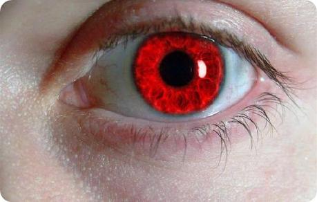 ojos-rojos-causas