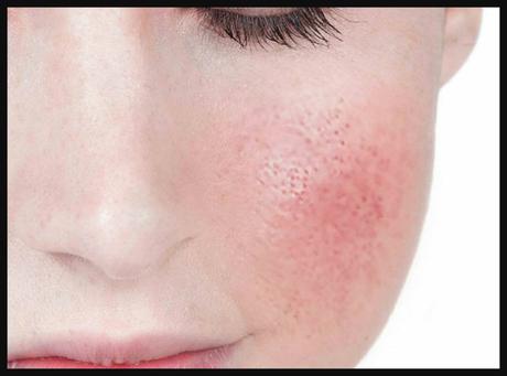 Belleza: Se Realista Parte I