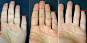 Lo que tu dedo meñique dice acerca de tu personalidad ¡Descúbrela! dedo-meñique-768x384