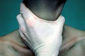 El riesgo y la autoagresión