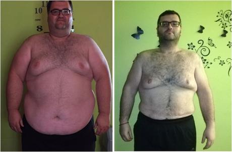 Nos gustan las historias reales: José Daniel, paciente intervenido con el Método Apollo