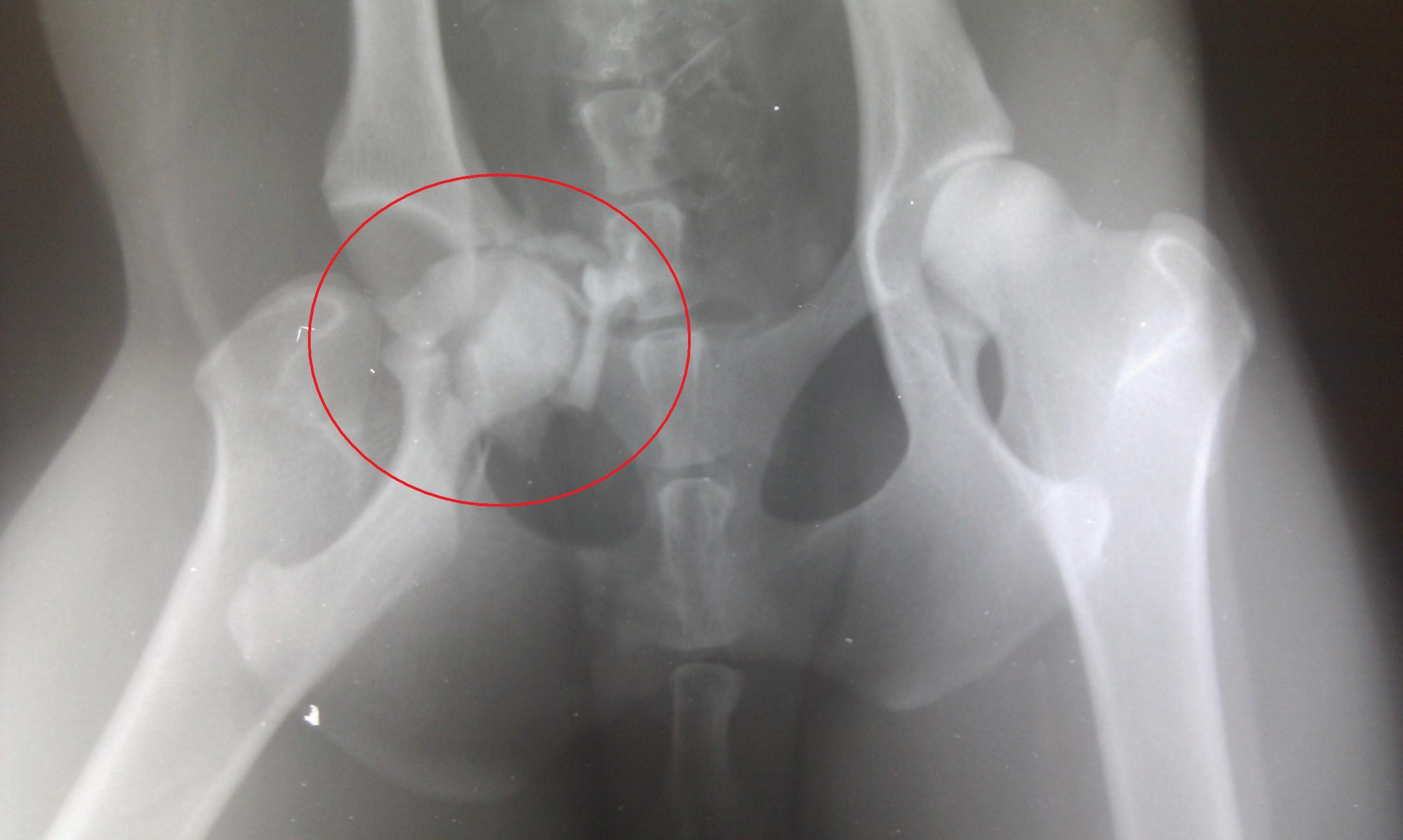 Galga atropellada y lanzada al carril contrario. AYUDA URGENTE!!!