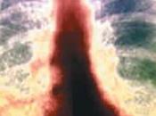 Bolivia mueren entre tuberculosis