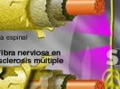 Nueva terapia podría mejorar pacientes esclerosis múltiple