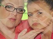 Inyecta bótox hija ocho años