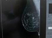 Ofrece IMSS mujeres atención integral todas etapas vida