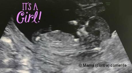 Mi tercer bebé es ¿niño o niña? Ecografía 12 semanas niña