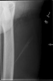 10 hechos sobre quimeras que quizá no sabías...