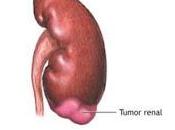 Primeros cambios Genéticos críticos pueden conducir Cáncer