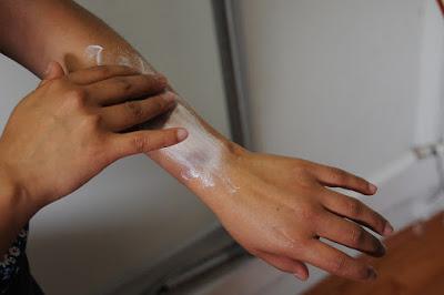 EMITE SECRETARÍA DE SALUD RECOMENDACIONES PARA PREVENIR DAÑOS EN PIEL DURANTE TEMPORADA DE CALOR