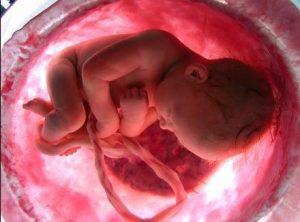 No se puede justificar el asesinato de una persona no nacida