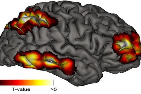 Misterios de la conciencia