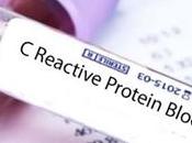 Proteína reactiva