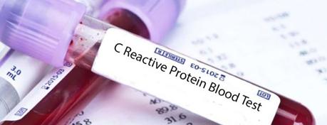 Proteína C reactiva Proteína C reactiva alta