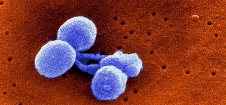 Meningitis Tratamiento de la meningitis