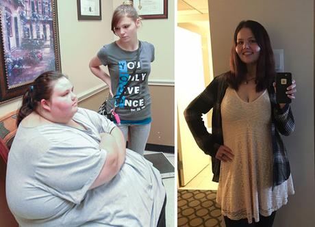 30 Fotos de antes y después de perder peso y los resultados son emocionantes
