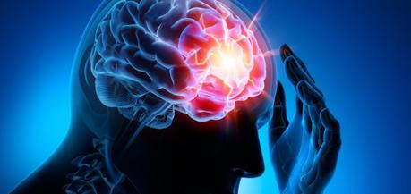 Cefalea Síntomas de la cefalea