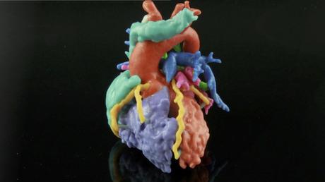 La impresión 3-D llega al corazón