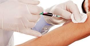 Análisis de sangre para predecir el Alzhéimer.