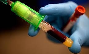 Análisis de sangre para predecir el Alzhéimer.