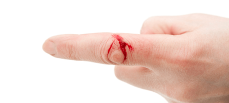 Usos del suero fisiológico