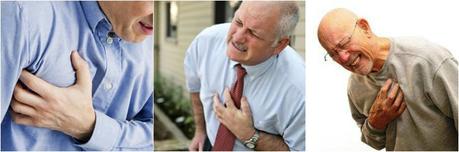 Síntomas del infarto de miocardio