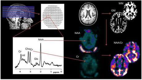 Las personas creen que una investigación es más confiable cuando incluyen imágenes cerebrales “extrañas”