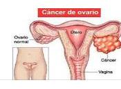 Cáncer Ovario difícil detectar Primeras Etapas