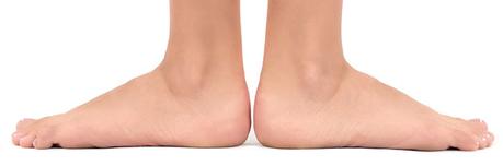 Pie plano Causas del pie plano