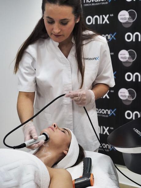 novasonix onix radiofrecuencia maria padilla