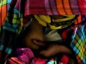 Jamila junto madre, supervivientes piel