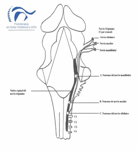 cefalea cervicogenica